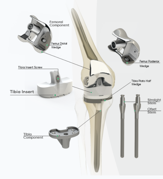 Titanium Implant Knee Replacement