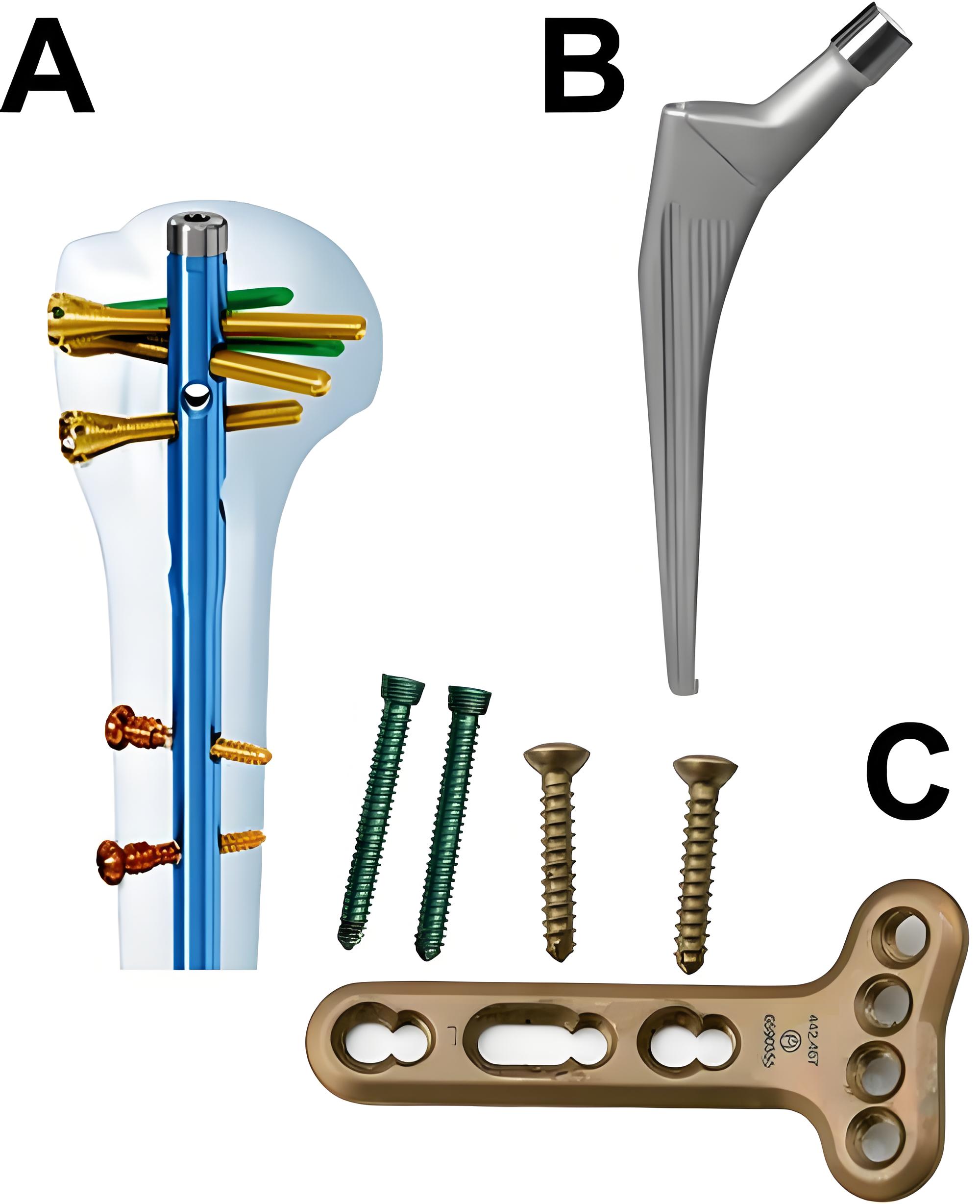 Medical implant applications using titanium bars and plates
