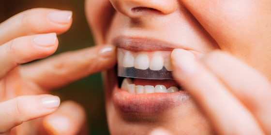 Teeth whitening strips for home oral care