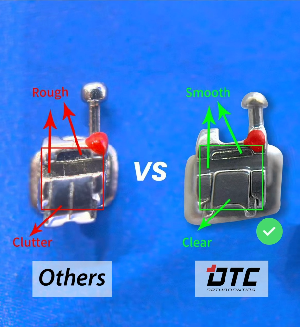 Comparison of surface finish and craftsmanship quality across orthodontic instruments