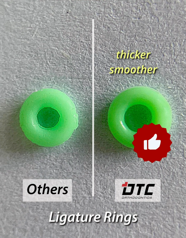 Elastic ligature rings used in fixed orthodontic treatment, shown side by side for buyer comparison