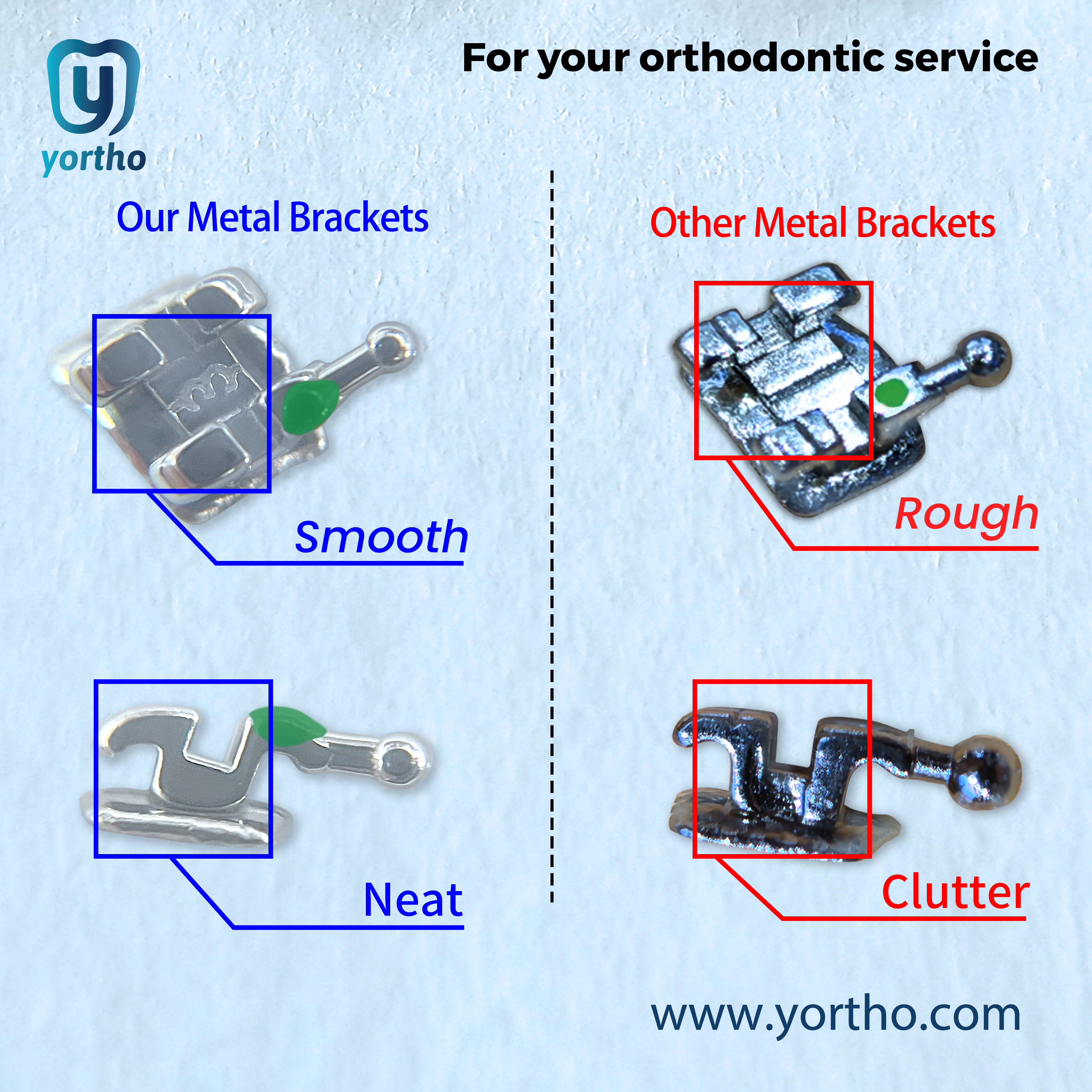Yortho metal brackets compared with other metal brackets showing surface and molding differences
