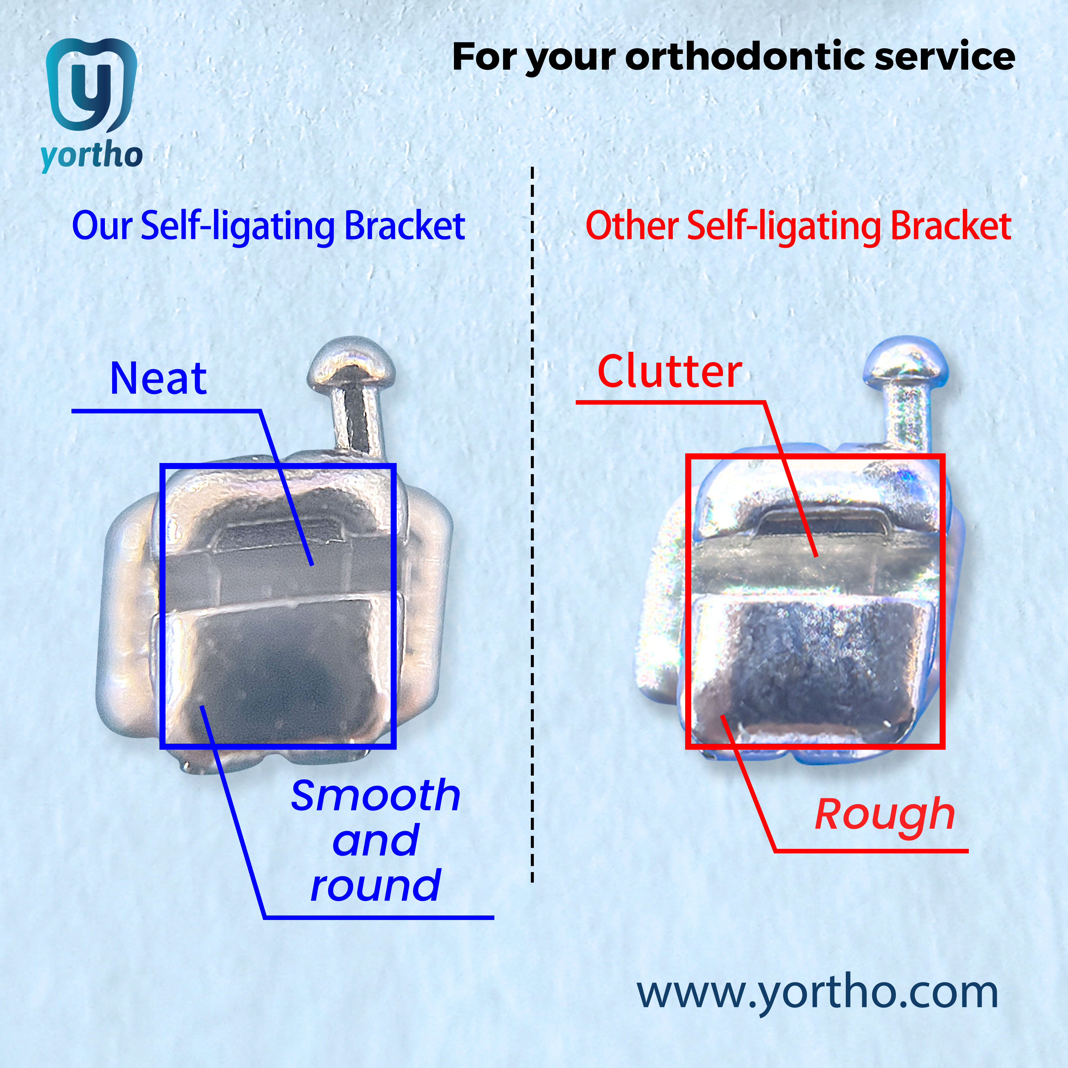 Yortho self-ligating metal brackets compared with Japanese self-ligating brackets