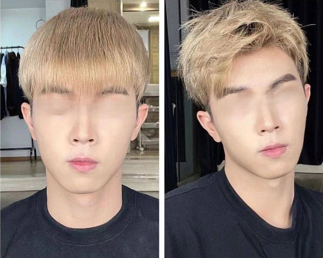 Before & After Photos