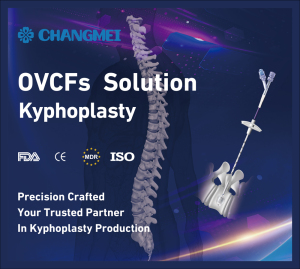 Kyphoplasty